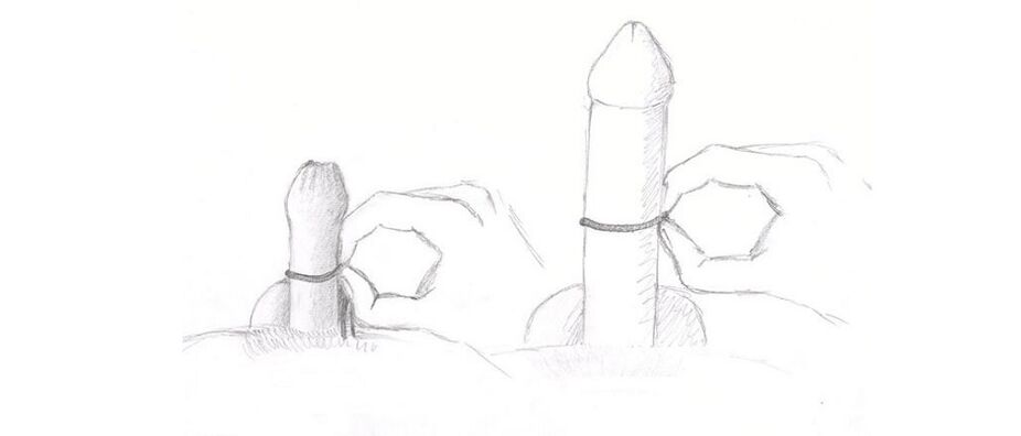 Penis Thickness Measurement